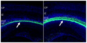 Cross-sectional micrographs of embryonic mouse brains at day 17 showing the layered nature of the brain. Low-choline brains (left) have significantly reduced numbers of progenitor cells (cyan, arrow), and total neuron count (blue) vs. normal-choline brains (right).